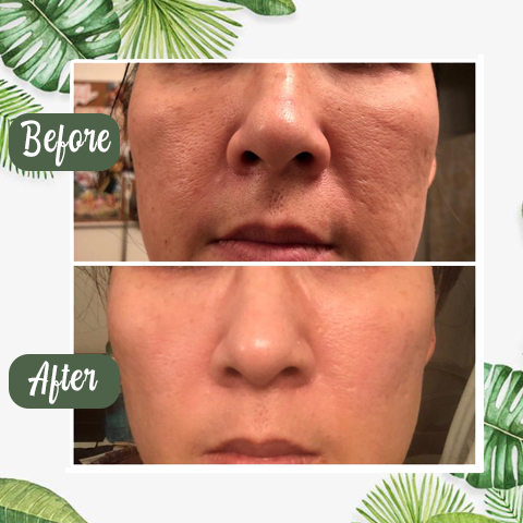 Buy 1 Get 1 Free - Green Tea Deep Cleanse Mask