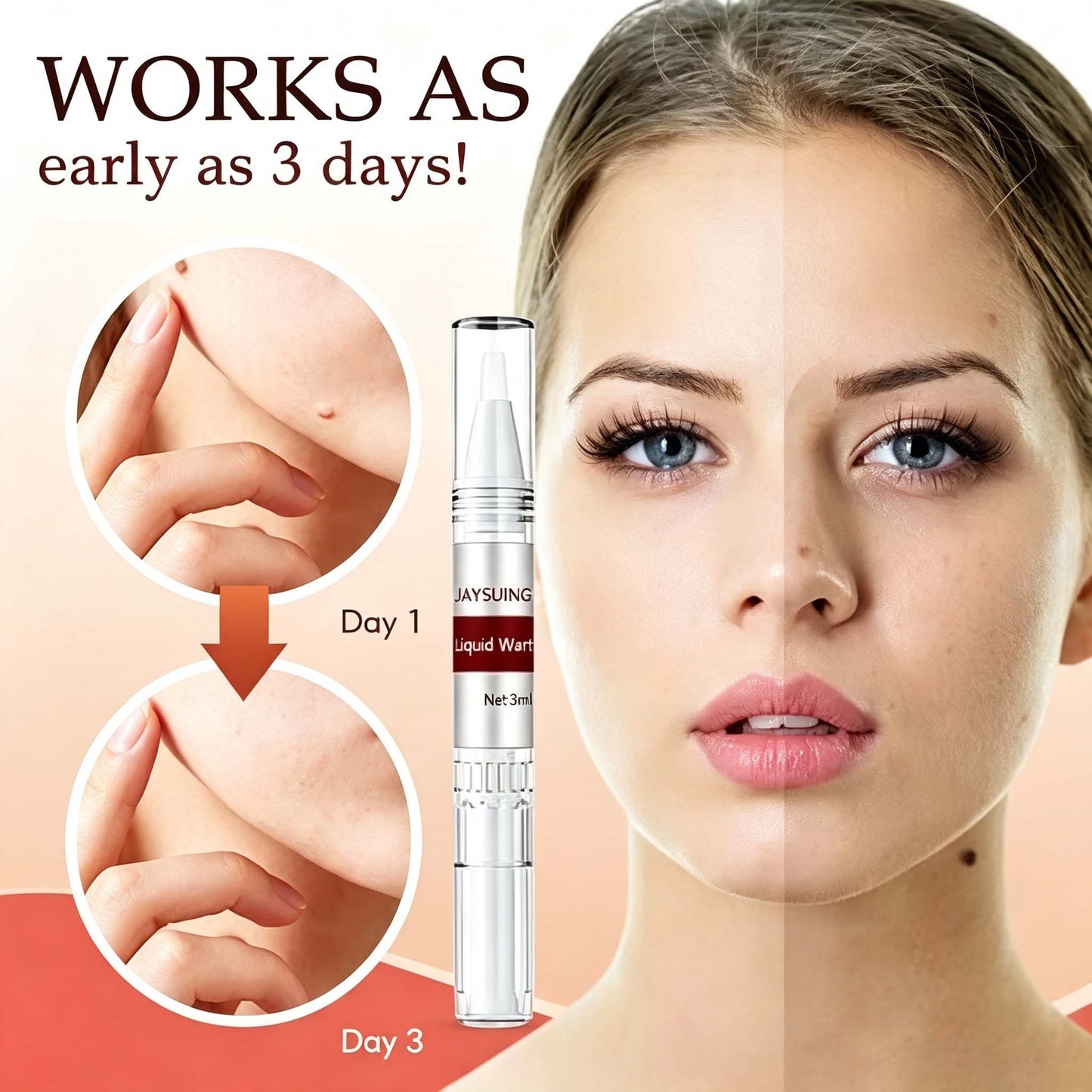 LAST DAY 50% OFF Tags & Moles Remover